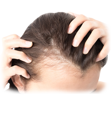 PRP Hair Treatment