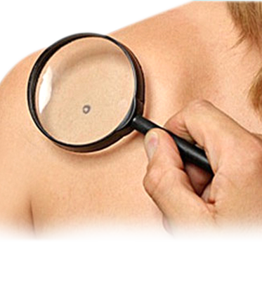 Warts and Tag Removal