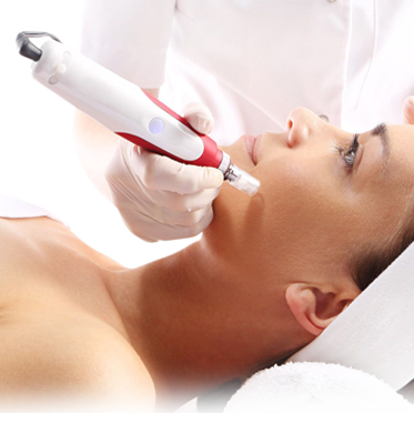 Microneedling